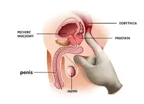 badanie prostaty